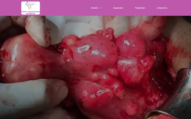 Captura de la web de Tratamiento mioma uterino